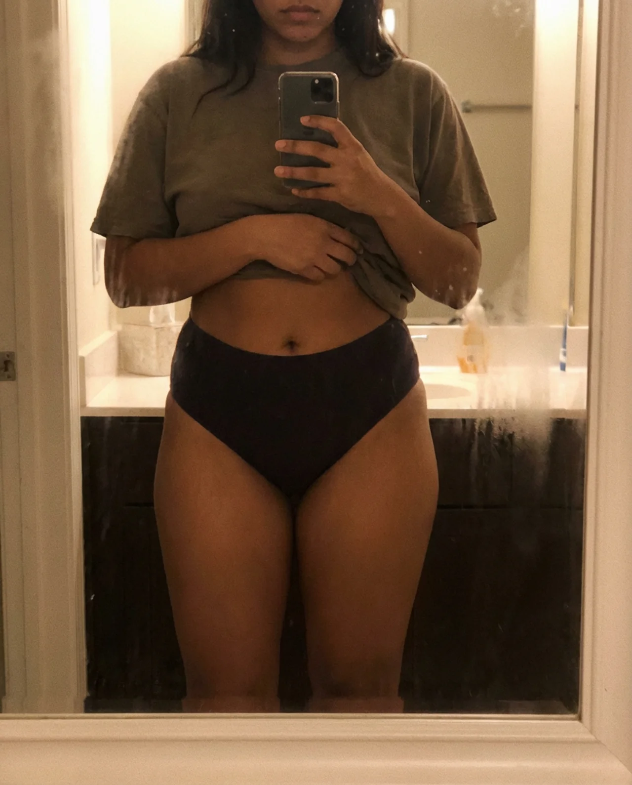 Customer result — stretch mark coverage